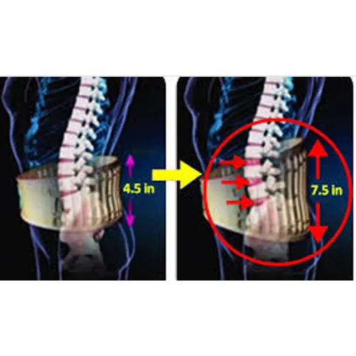 CEINTURE TRACTION LOMBAIRE